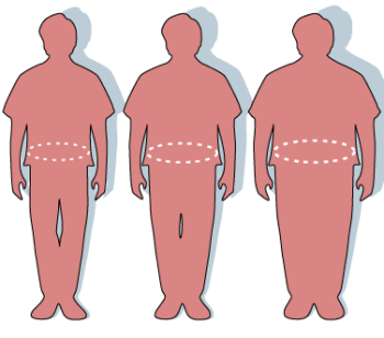 More than half of EU adults were overweight in 2025, Eurostat finds